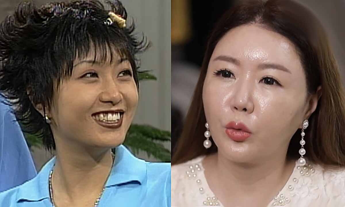 뇌종양 투병 중 사망? 방송서 사라진 이의정 현재 상태